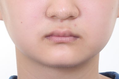 부산청소년교정치과