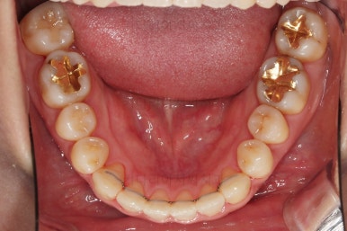 부산연산동치과