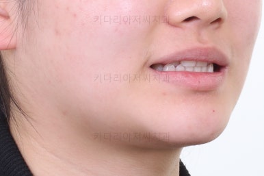 연산동교정치과