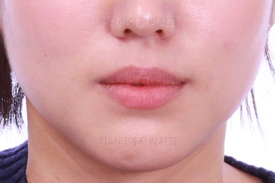 부산치아교정잘하는곳