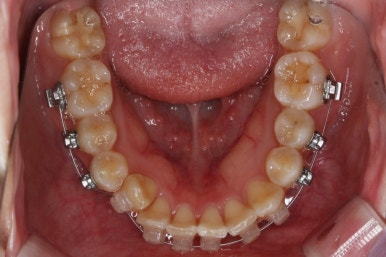 연산동교정치과