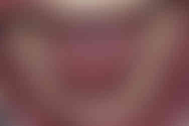 부산주걱턱교정