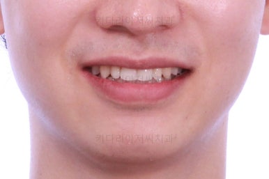 부산연제구교정