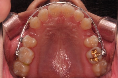 연산동치아교정치과