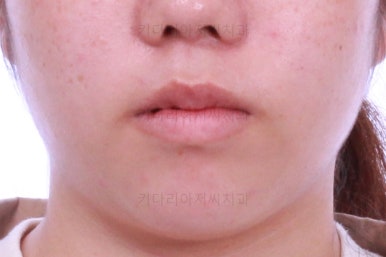 부산교정전문치과