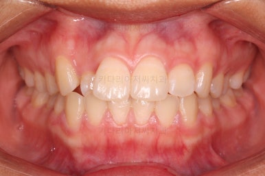 사직동교정치과