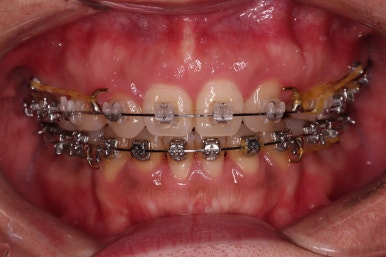 연산동교정치과