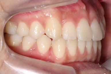 부산연산동청소년교정