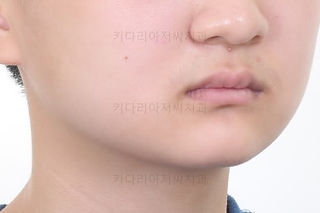 부산청소년교정치과