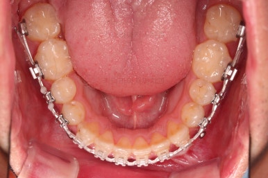 부산긴얼굴긴턱교정