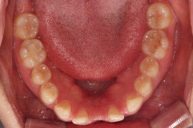 부산교정치과추천