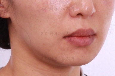 부산연산동교정치과
