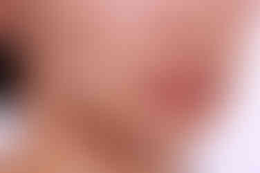 부산연산동교정치과