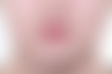 부산연산동사랑니발치
