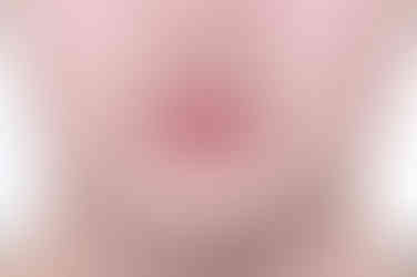 부산연산동사랑니발치