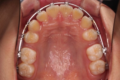 부산치아교정치과