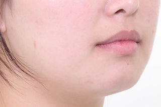 부산치아교정치과