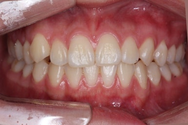 부산치아교정잘하는곳