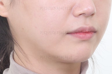 연산동교정치과