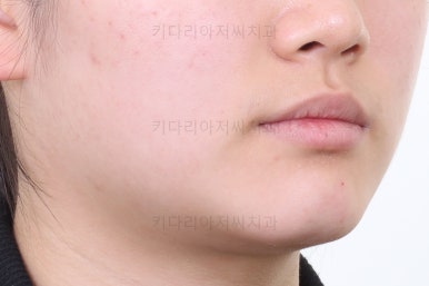 연산동교정치과