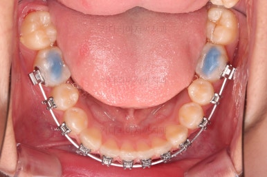 부산청소년교정치과