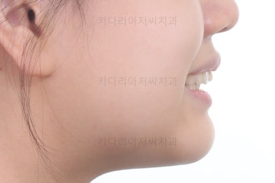 부산교정전문의