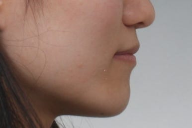 부산교정전문의