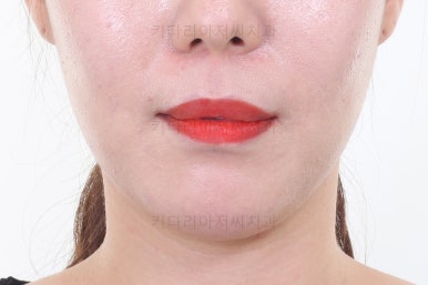 연산동교정치과