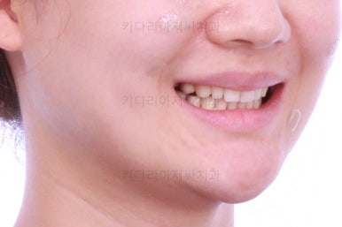 부산인비절라인