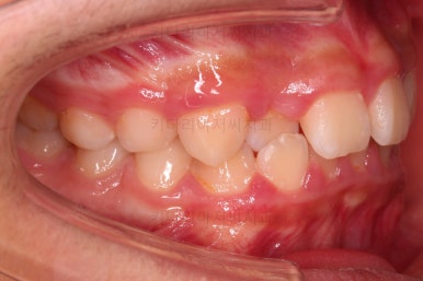 부산청소년교정