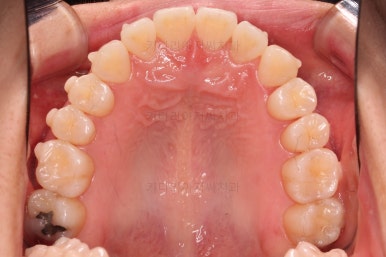 부산인비절라인