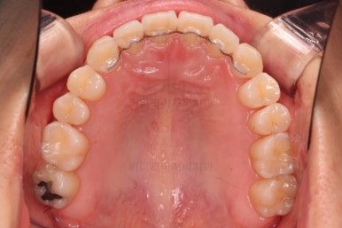 부산인비절라인