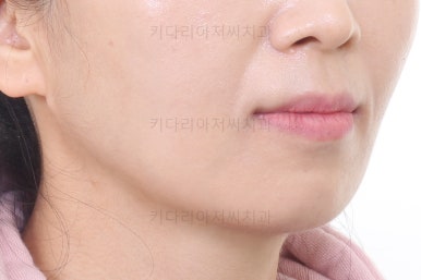 부산인비절라인