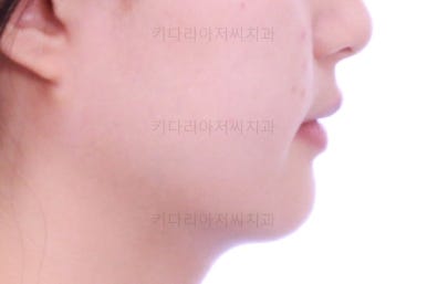 동래구치아교정