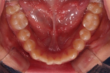 부산청소년교정치과
