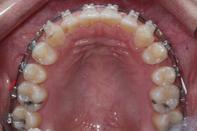 부산치아교정치과