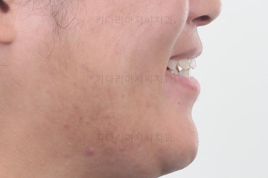 연산동교정