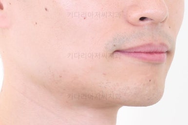 부산치아교정