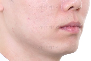 부산교정치과