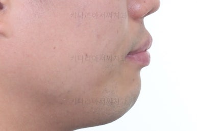 부산교정치과추천