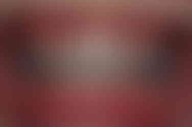 부산비발치교정