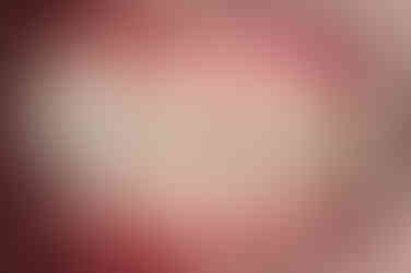 부산치아교정잘하는곳