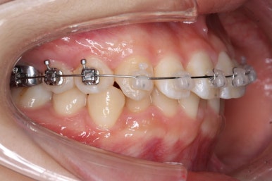 연산동교정치과