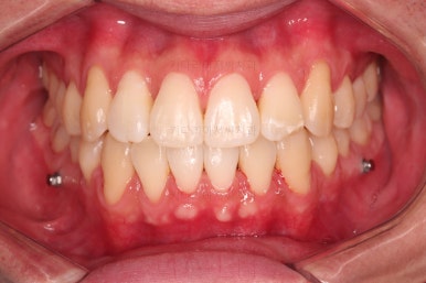 부산인비절라인