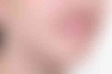 부산투명교정
