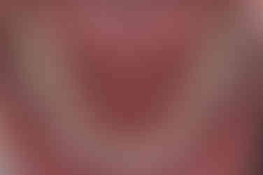 부산왜소치교정