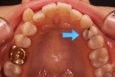 부산인비절라인