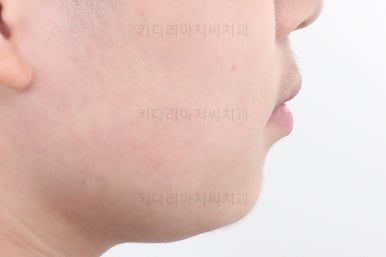 부산어린이교정