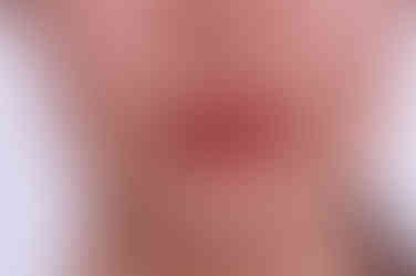 부산부분치아교정