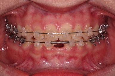 부산교정치과추천